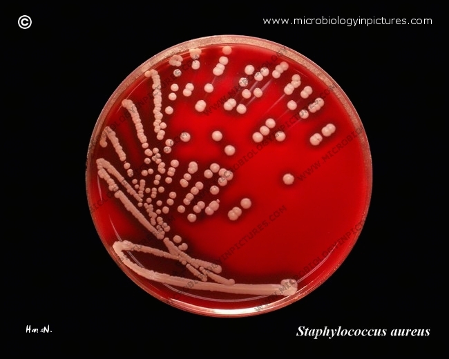 s.aureus streaked on agar